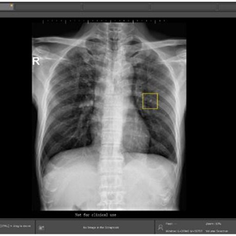  胸部 X 线智能诊断系统;章鱼通智能产品