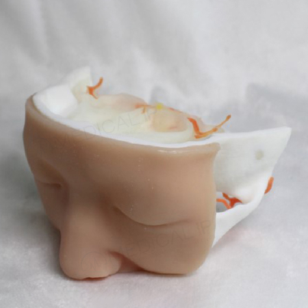 脑垂体肿瘤3D打印仿真模型;人工智能与机器人产业平台智能产品