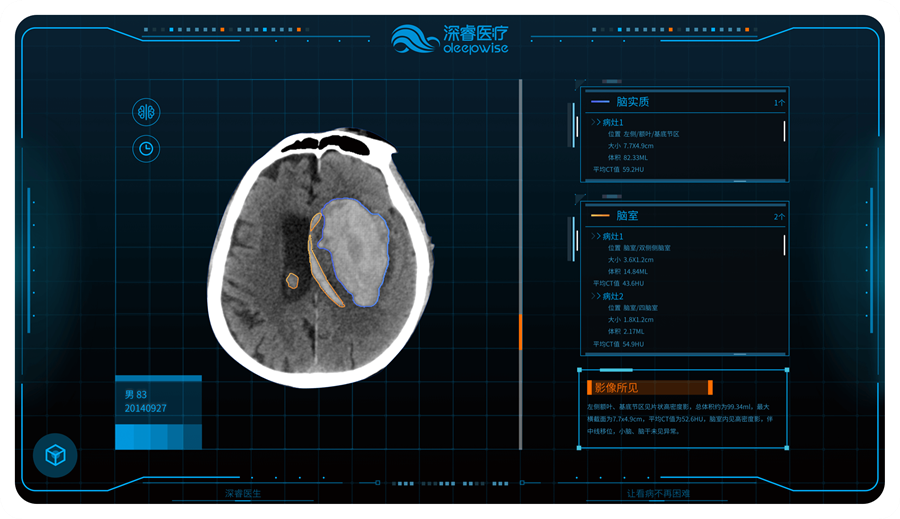 dwbrain@2x.png