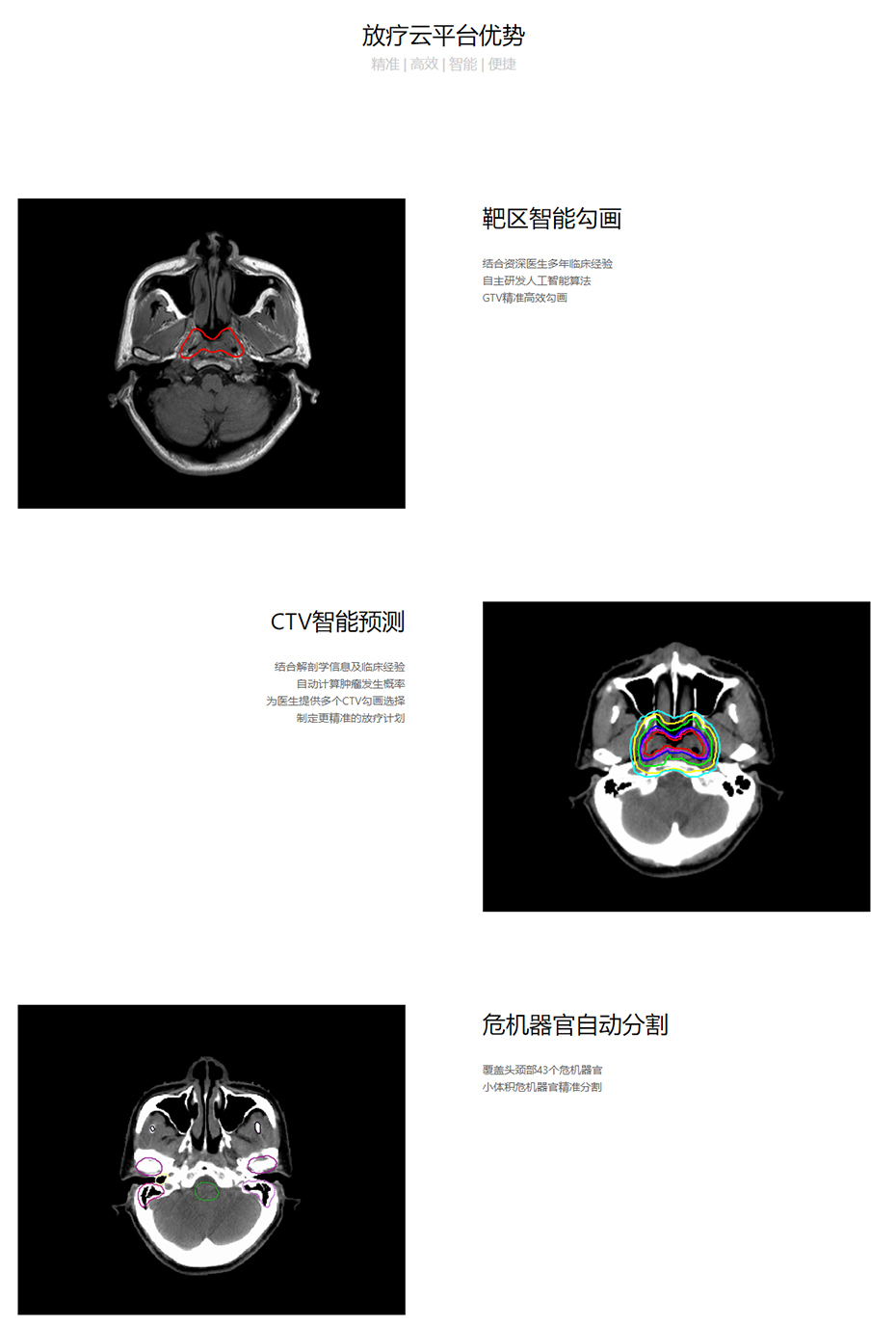 柏视医疗科技有限公司 - PVmed.jpg