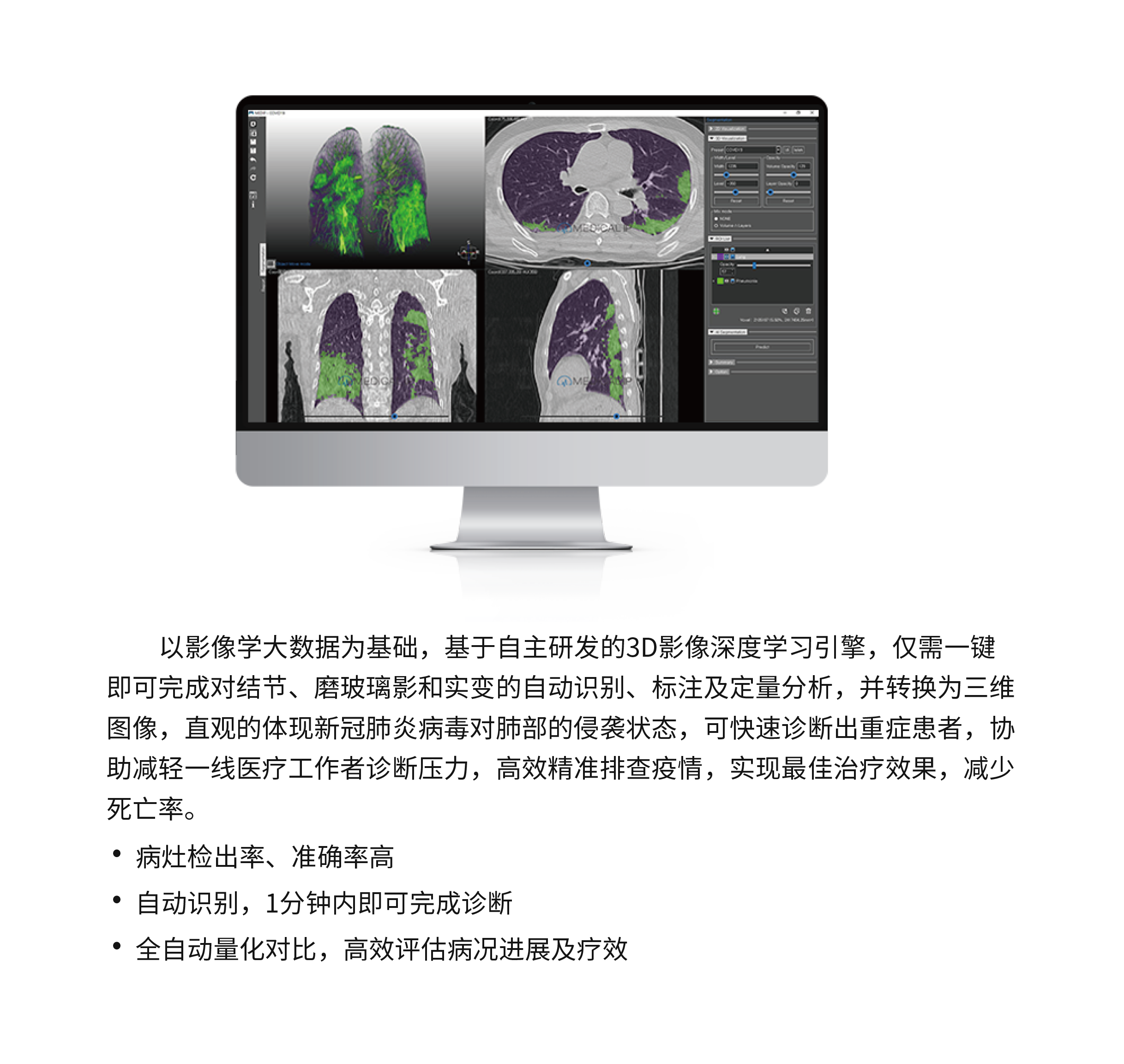 医学影像三维可视化服务2021-5.png