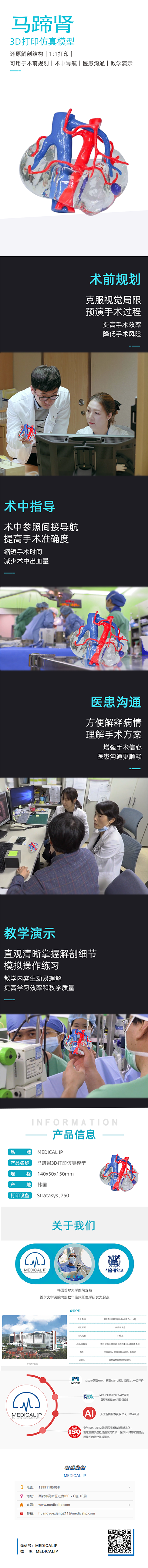马蹄肾3D打印仿真模型（兑换：5100）.png