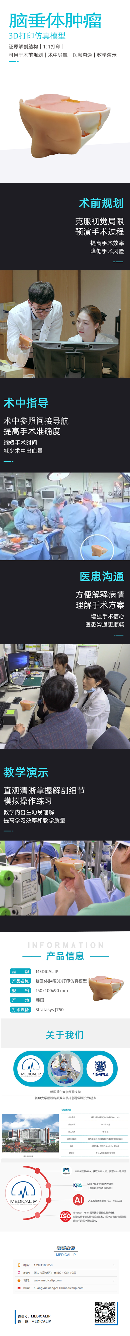 脑垂体肿瘤3D打印仿真模型（兑换：16500）.png